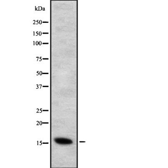 CYB5B Antibody in Western Blot (WB)