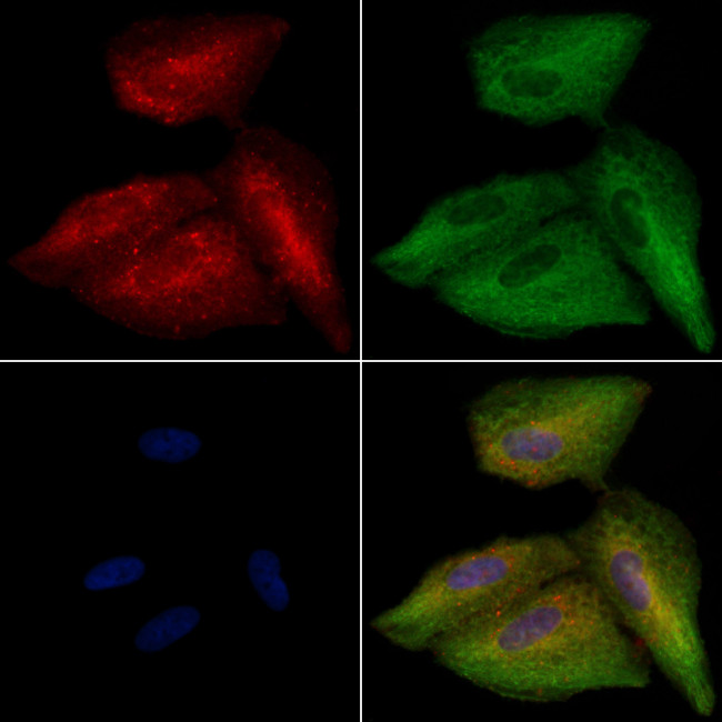 FAIM Antibody in Immunocytochemistry (ICC/IF)