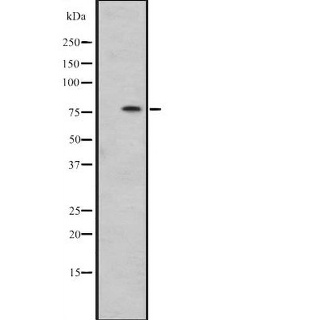 HSPA12B Antibody in Western Blot (WB)
