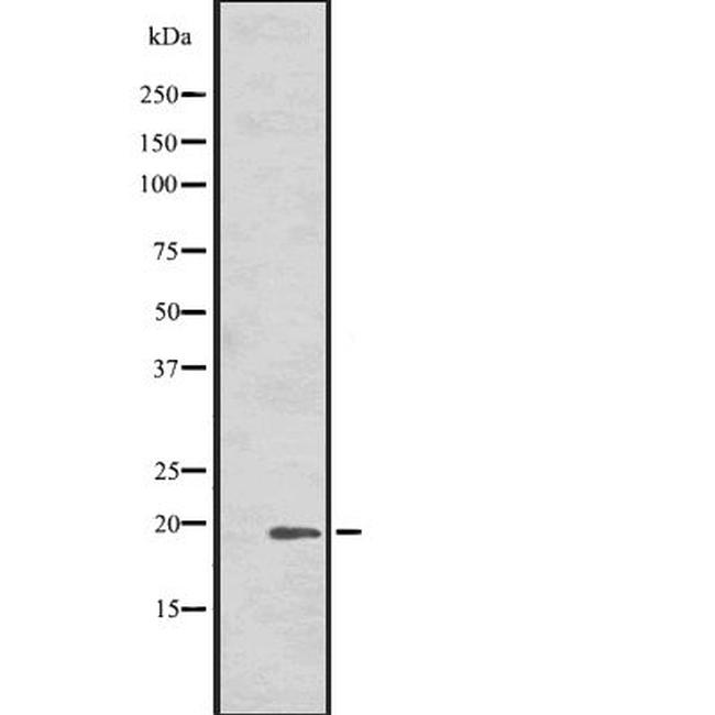 HSPB7 Antibody in Western Blot (WB)