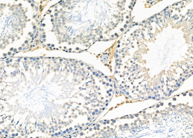 IGFBPL1 Antibody in Immunohistochemistry (Paraffin) (IHC (P))