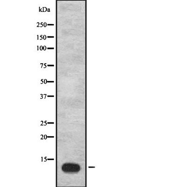 IGFL1 Antibody in Western Blot (WB)