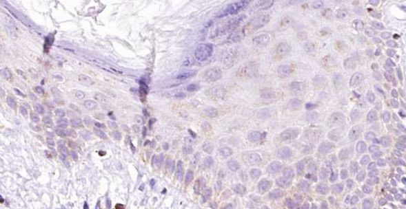 IL1F10 Antibody in Immunohistochemistry (Paraffin) (IHC (P))