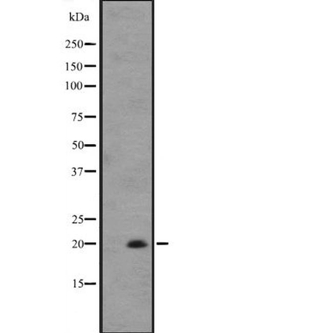IL-25 Antibody in Western Blot (WB)