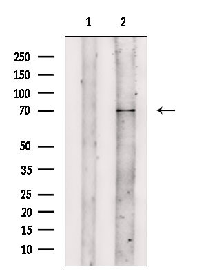 IFNAR2 Antibody in Western Blot (WB)