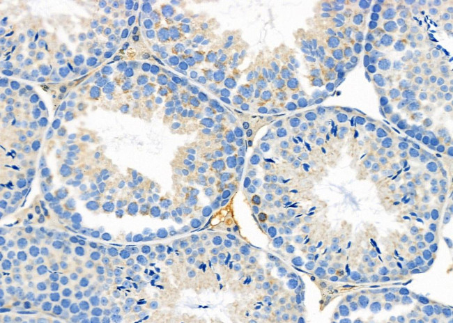 ITGA10 Antibody in Immunohistochemistry (Paraffin) (IHC (P))