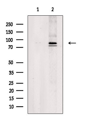 ITGB6 Antibody in Western Blot (WB)
