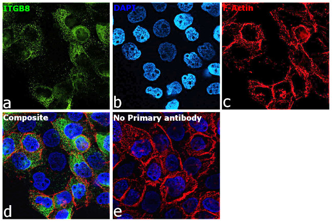 ITGB8 Antibody in Immunocytochemistry (ICC/IF)