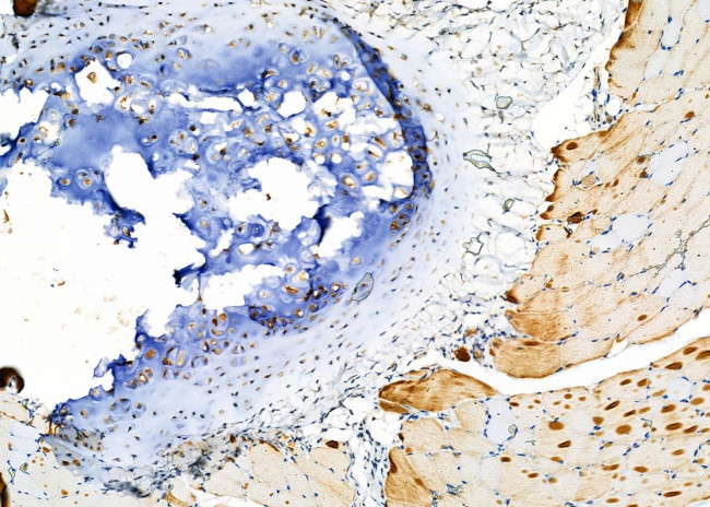 Cytokeratin 31/33A/33B Antibody in Immunohistochemistry (Paraffin) (IHC (P))
