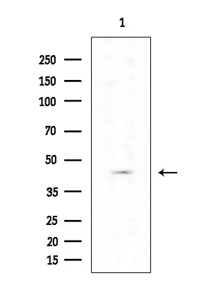 Cytokeratin 85/86 Antibody in Western Blot (WB)