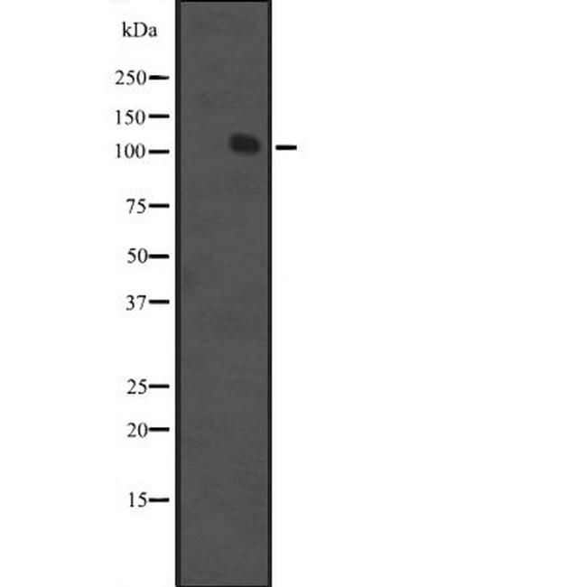 MCF2 Antibody in Western Blot (WB)
