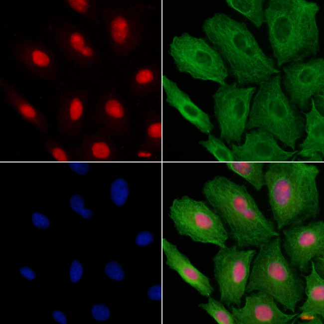 PAK1IP1 Antibody in Immunocytochemistry (ICC/IF)