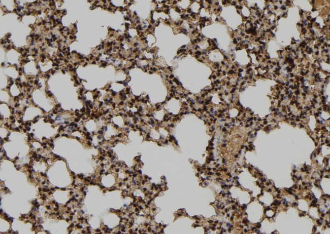 TUBD1 Antibody in Immunohistochemistry (Paraffin) (IHC (P))
