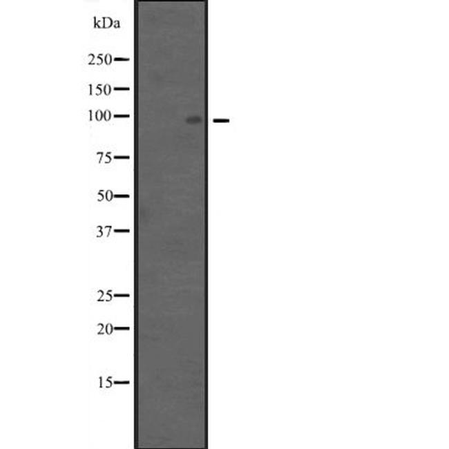 APC4 Antibody in Western Blot (WB)