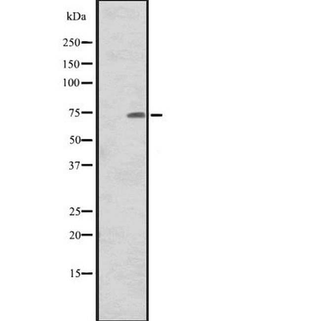 CNNM1 Antibody in Western Blot (WB)
