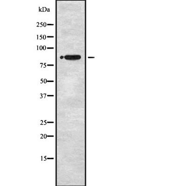 STRN1/STRN3 Antibody in Western Blot (WB)