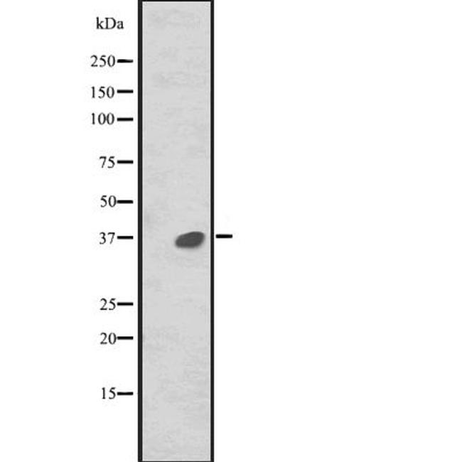 MAPRE2 Antibody in Western Blot (WB)