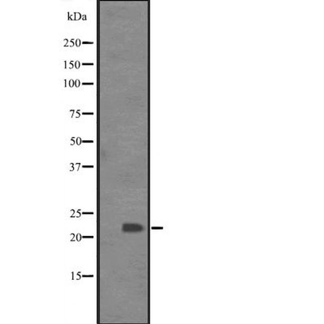 BCL7C Antibody in Western Blot (WB)