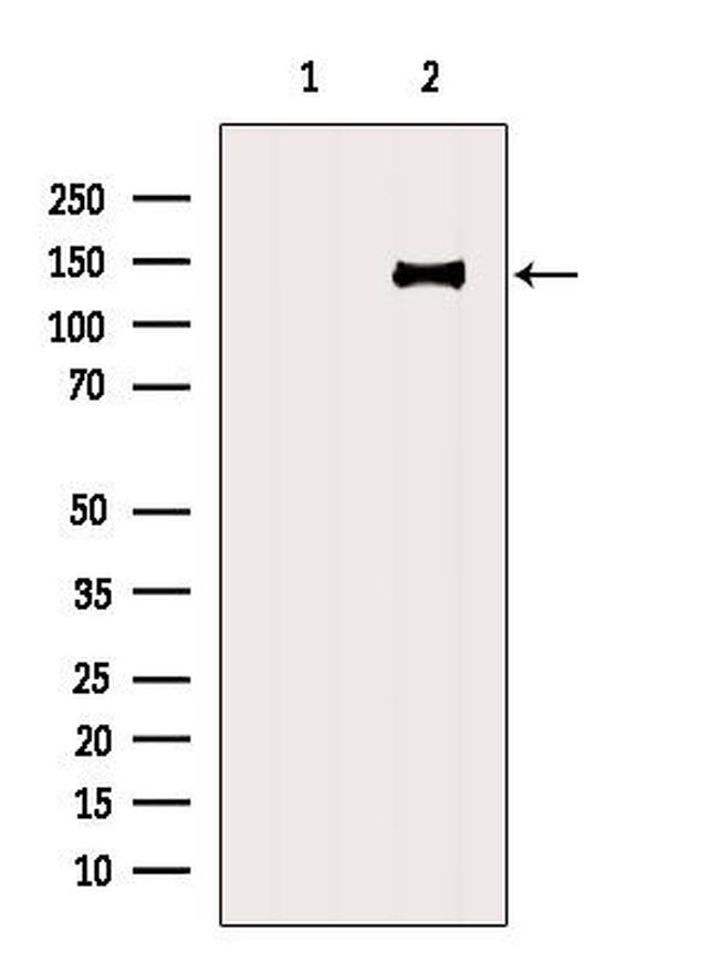 CC2D1A Antibody in Western Blot (WB)