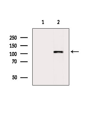 SMARCAD1 Antibody in Western Blot (WB)