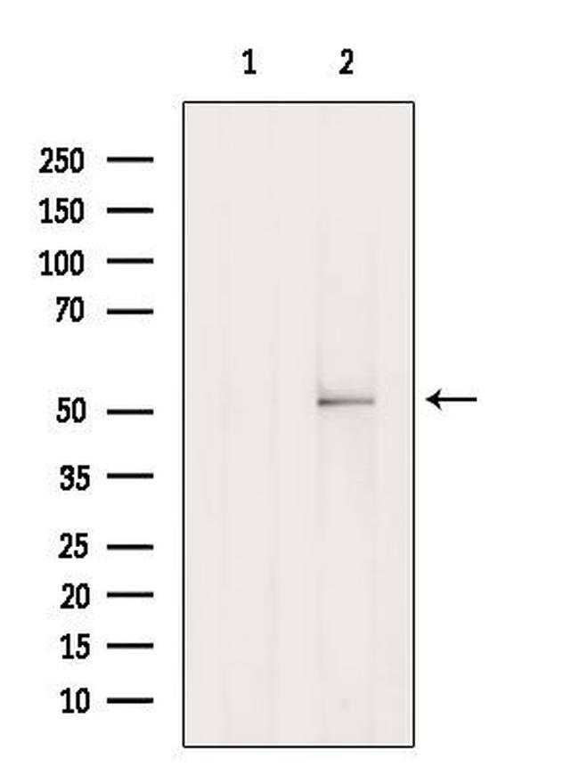 ORC5L Antibody in Western Blot (WB)