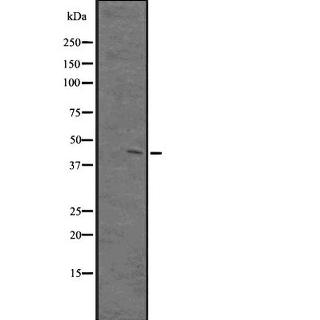PKNOX1 Antibody in Western Blot (WB)