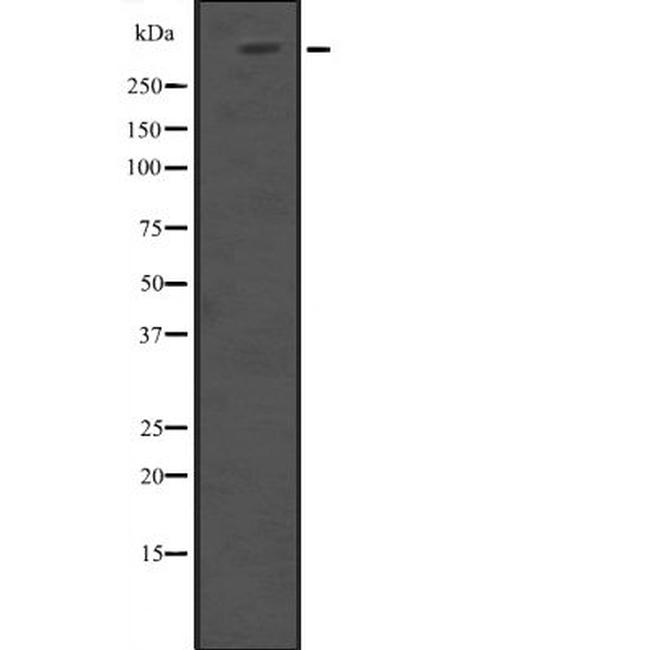 HUWE1 Antibody in Western Blot (WB)