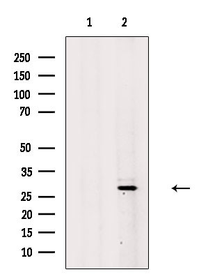 ING5 Antibody in Western Blot (WB)