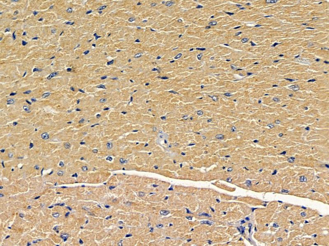 RASAL2 Antibody in Immunohistochemistry (Paraffin) (IHC (P))