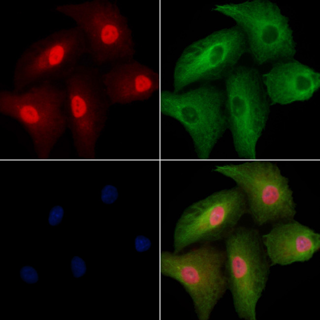NRK Antibody in Immunocytochemistry (ICC/IF)