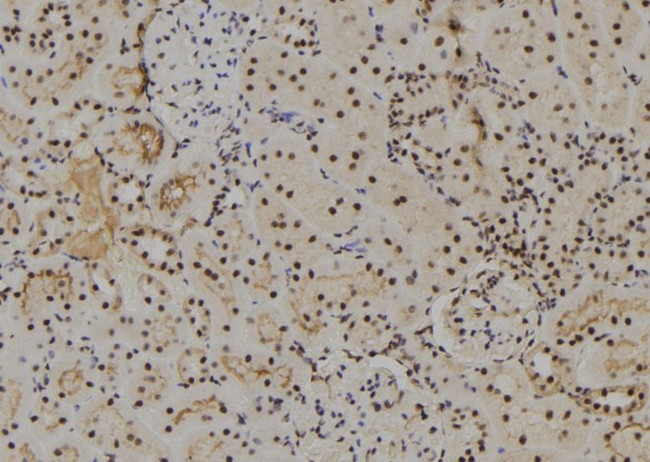 NUAK2 Antibody in Immunohistochemistry (Paraffin) (IHC (P))
