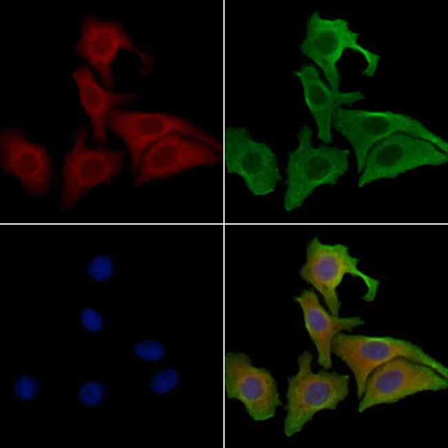 PRKD3 Antibody in Immunocytochemistry (ICC/IF)