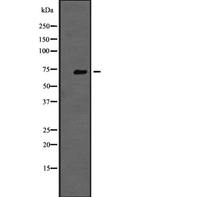 TNK1 Antibody in Western Blot (WB)