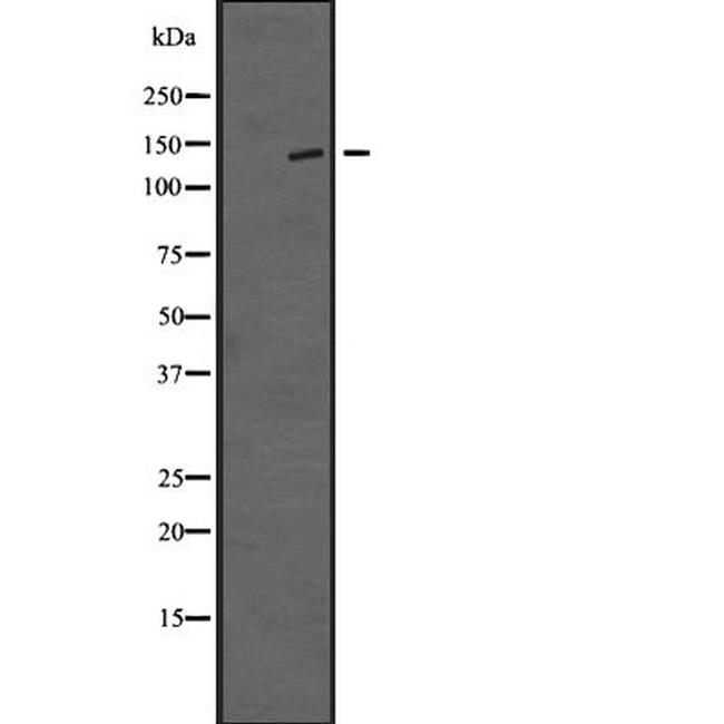 TTBK1 Antibody in Western Blot (WB)