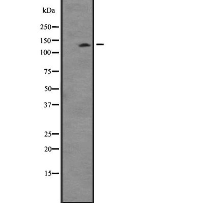 TTBK2 Antibody in Western Blot (WB)