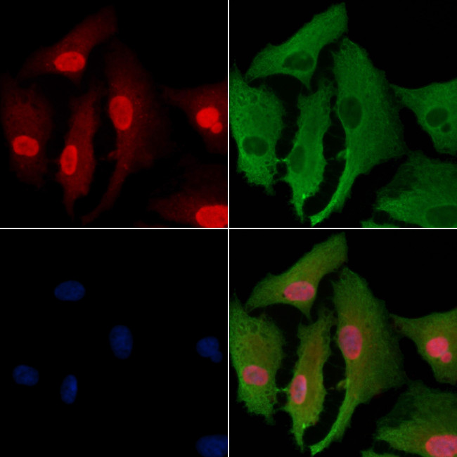 SGK494 Antibody in Immunocytochemistry (ICC/IF)