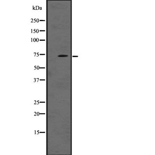 LRRN1 Antibody in Western Blot (WB)