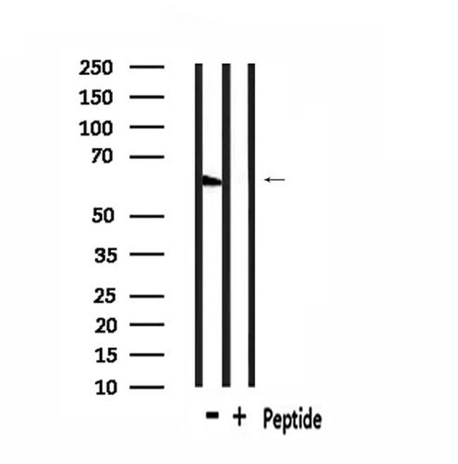 GPR148 Antibody in Western Blot (WB)