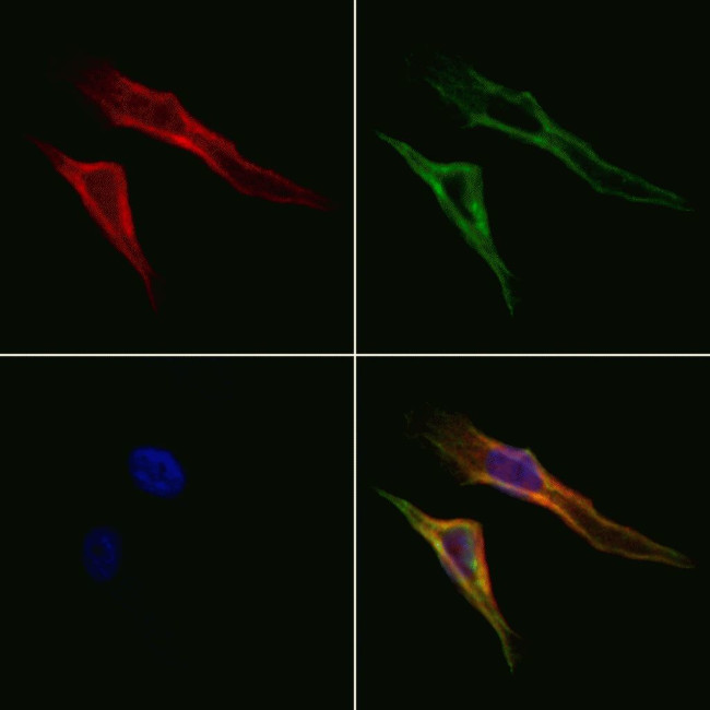 GPR63 Antibody in Immunocytochemistry (ICC/IF)