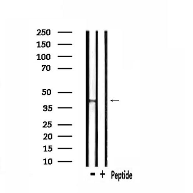 NPBWR2 Antibody in Western Blot (WB)