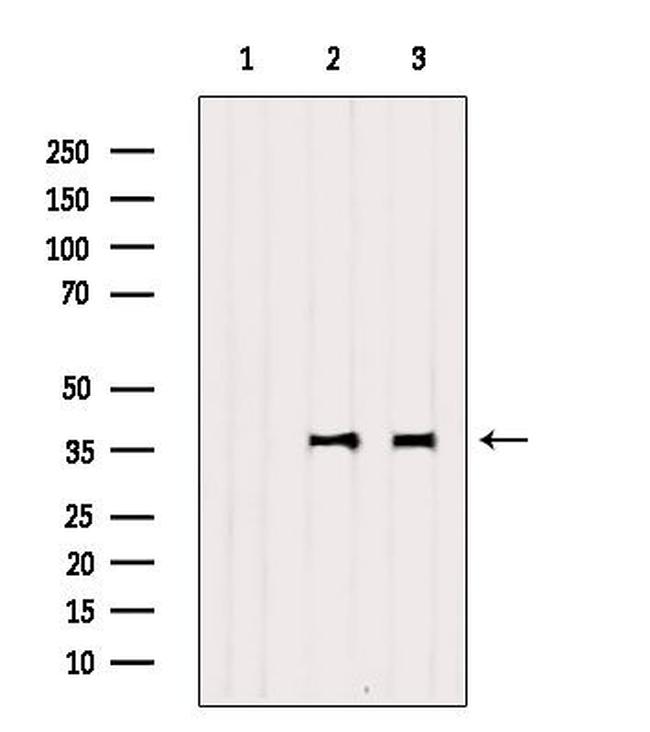 NPBWR2 Antibody in Western Blot (WB)
