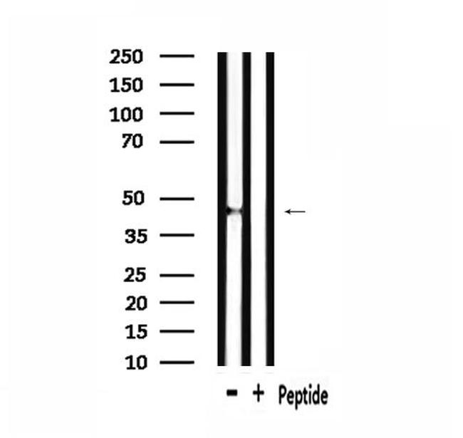 GNRHR2 Antibody in Western Blot (WB)