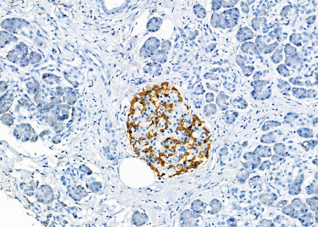 GPR33 Antibody in Immunohistochemistry (Paraffin) (IHC (P))
