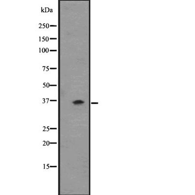 OR2T6 Antibody in Western Blot (WB)
