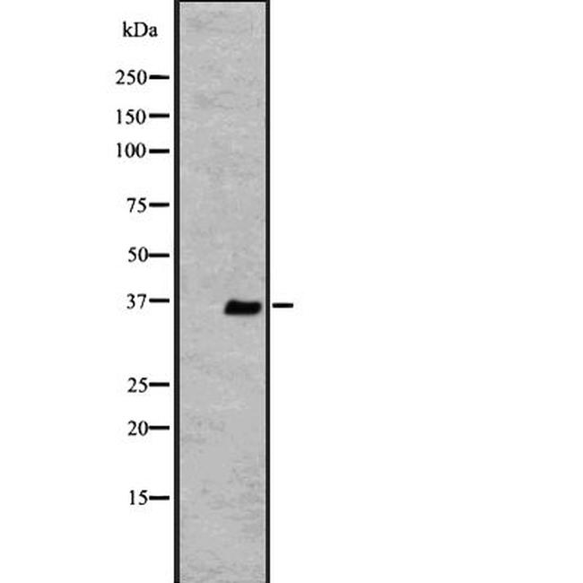 OR2V2 Antibody in Western Blot (WB)