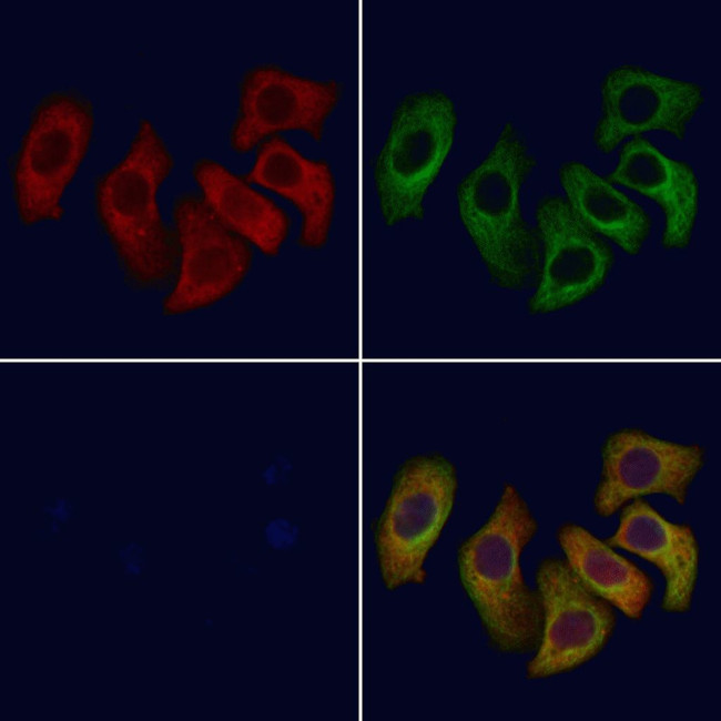 CCR9 Antibody in Immunocytochemistry (ICC/IF)