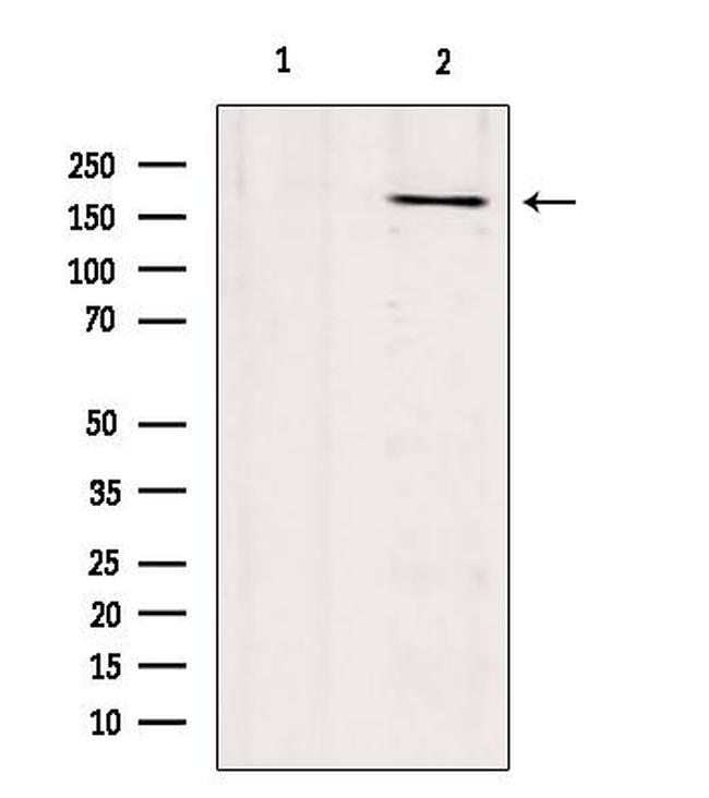 COL17A1 Antibody in Western Blot (WB)