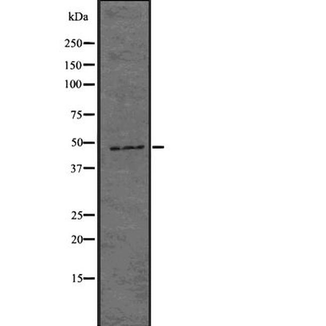 HAPLN1 Antibody in Western Blot (WB)