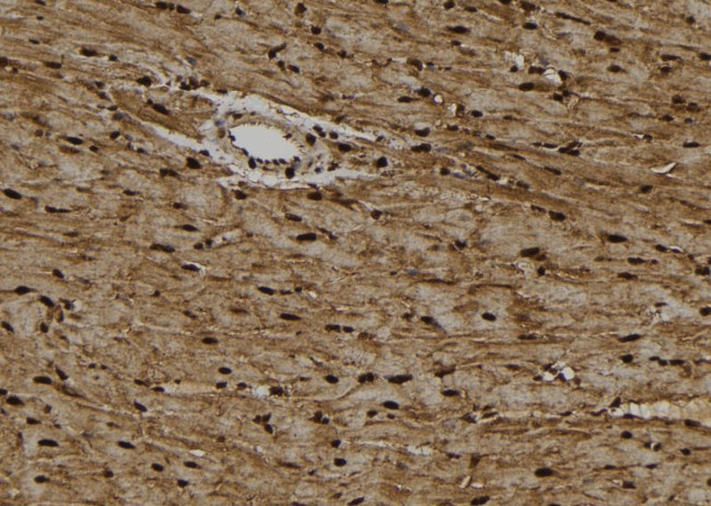 KIFC1 Antibody in Immunohistochemistry (Paraffin) (IHC (P))