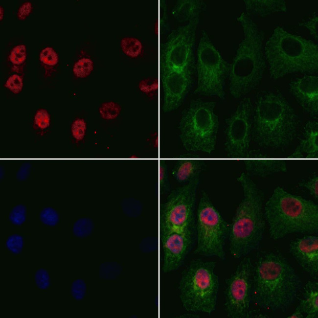 OTX1 Antibody in Immunocytochemistry (ICC/IF)